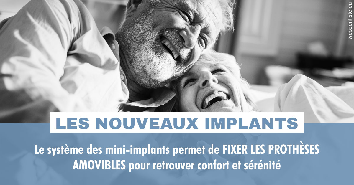 https://dr-tran-minh-thien.chirurgiens-dentistes.fr/Les nouveaux implants 2