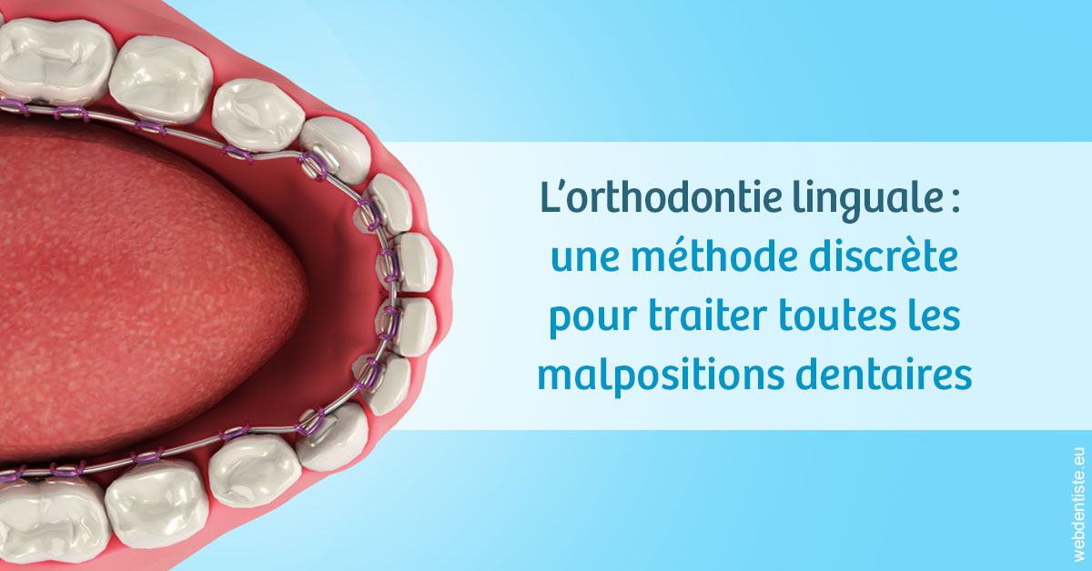 https://dr-tran-minh-thien.chirurgiens-dentistes.fr/L'orthodontie linguale 1