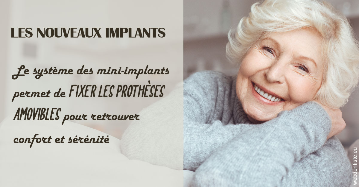 https://dr-tran-minh-thien.chirurgiens-dentistes.fr/Les nouveaux implants 1
