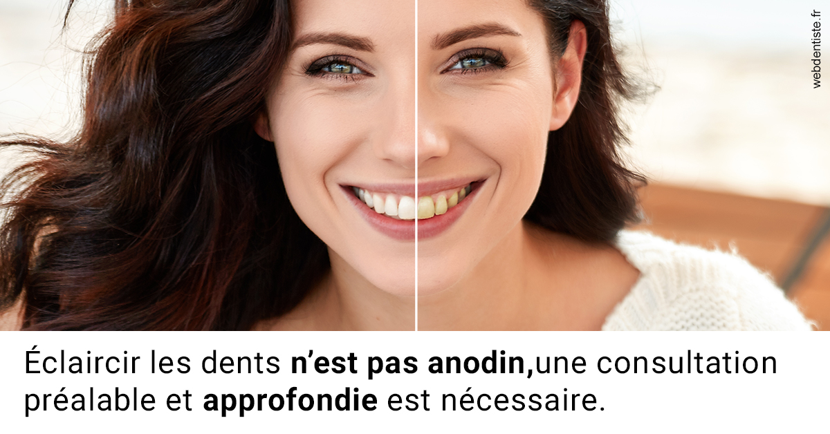 https://dr-tran-minh-thien.chirurgiens-dentistes.fr/Le blanchiment 2