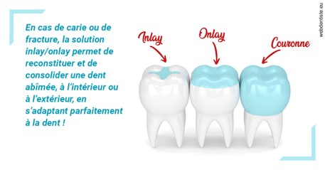 https://dr-tran-minh-thien.chirurgiens-dentistes.fr/L'INLAY ou l'ONLAY