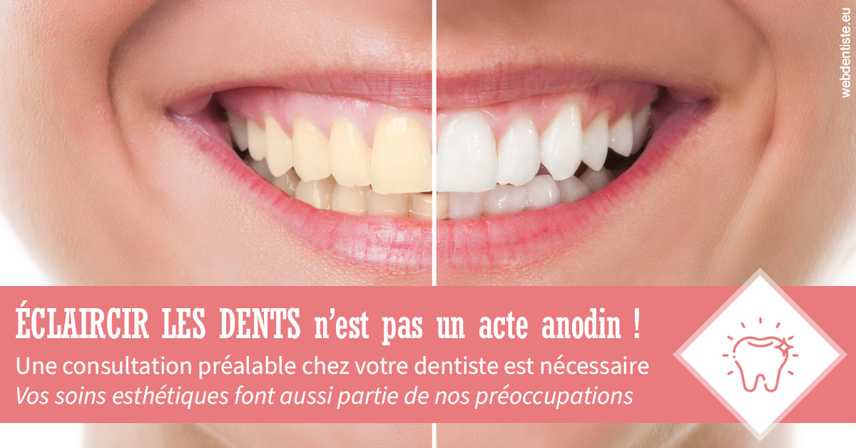 https://dr-tran-minh-thien.chirurgiens-dentistes.fr/Eclaircir les dents 1