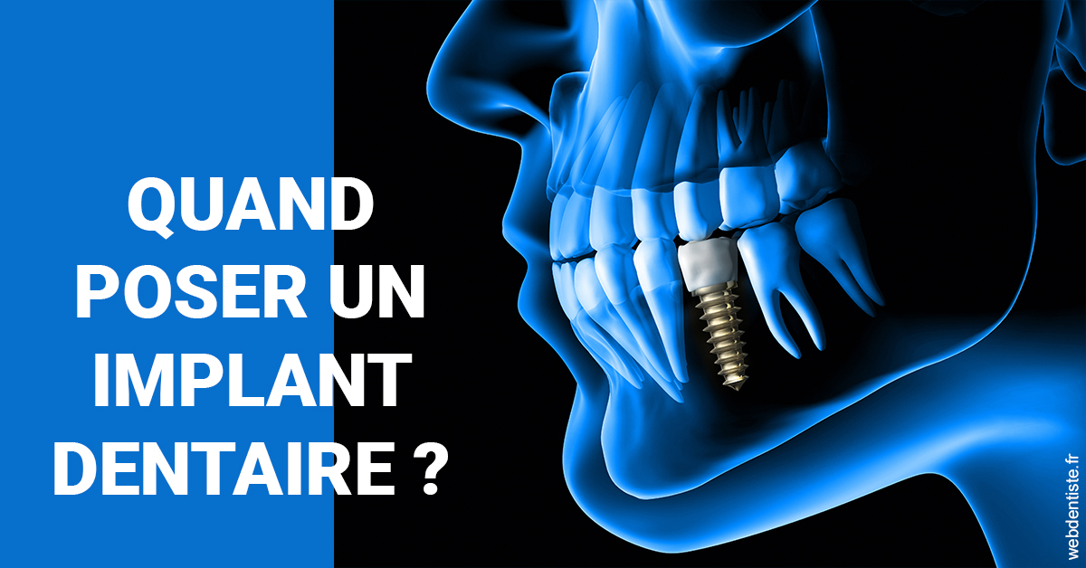https://dr-tran-minh-thien.chirurgiens-dentistes.fr/Les implants 1