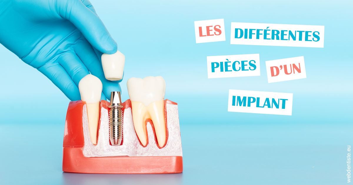 https://dr-tran-minh-thien.chirurgiens-dentistes.fr/Les différentes pièces d’un implant 2