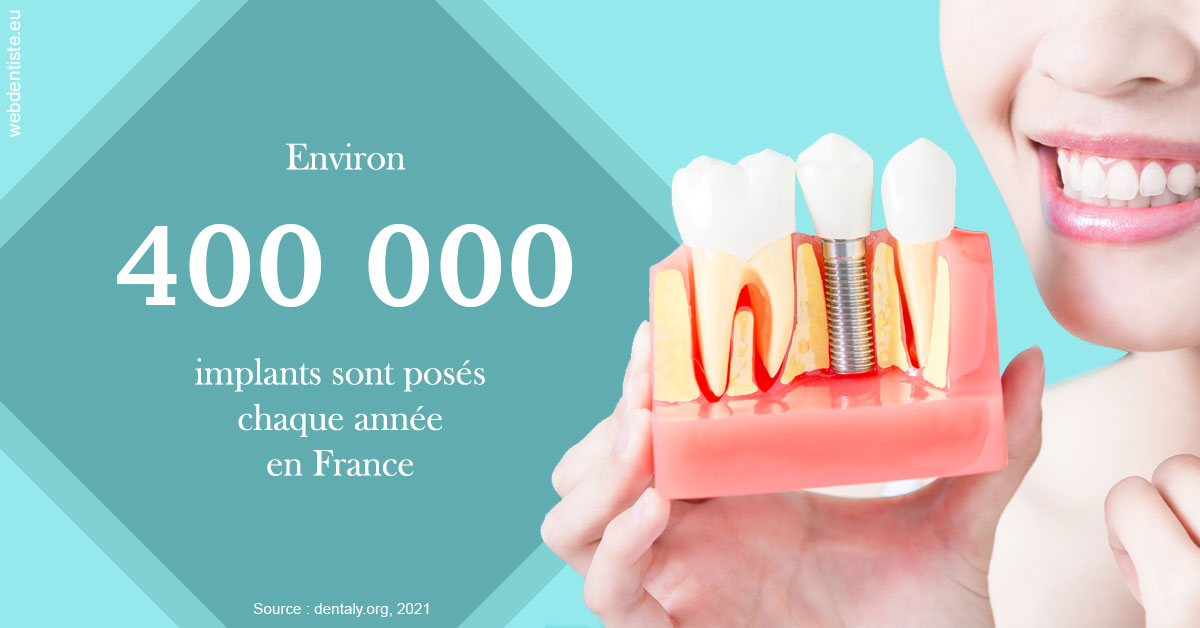 https://dr-tran-minh-thien.chirurgiens-dentistes.fr/Pose d'implants en France 2