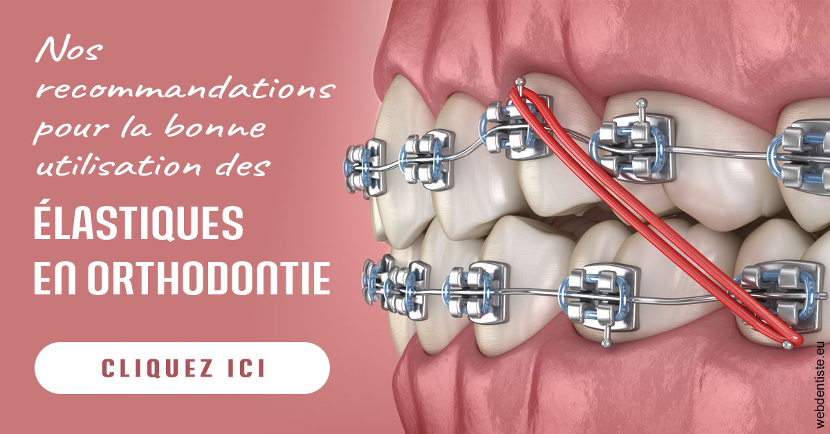 https://dr-tran-minh-thien.chirurgiens-dentistes.fr/Elastiques orthodontie 2